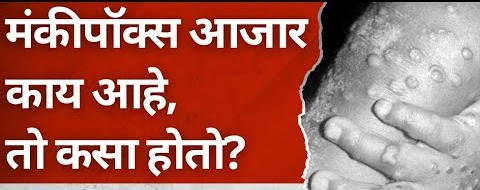 मंकीपॉक्स म्हणजे काय? लक्षणे, लस उपचार, दुष्परिणाम……